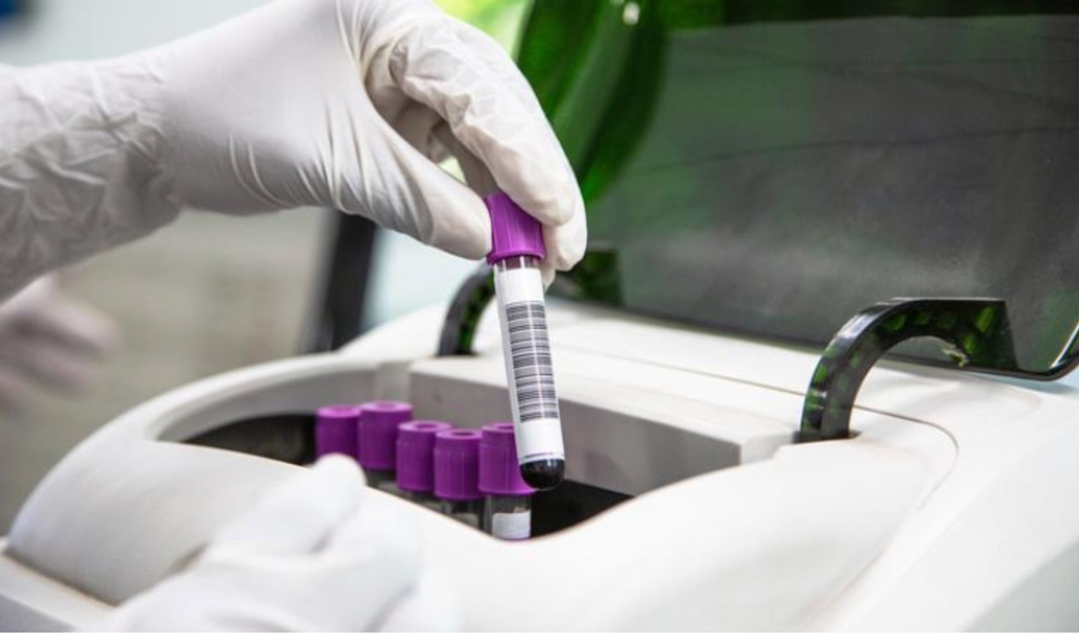 gehandschoende hand pakt laboratoriumbuisje met barcode